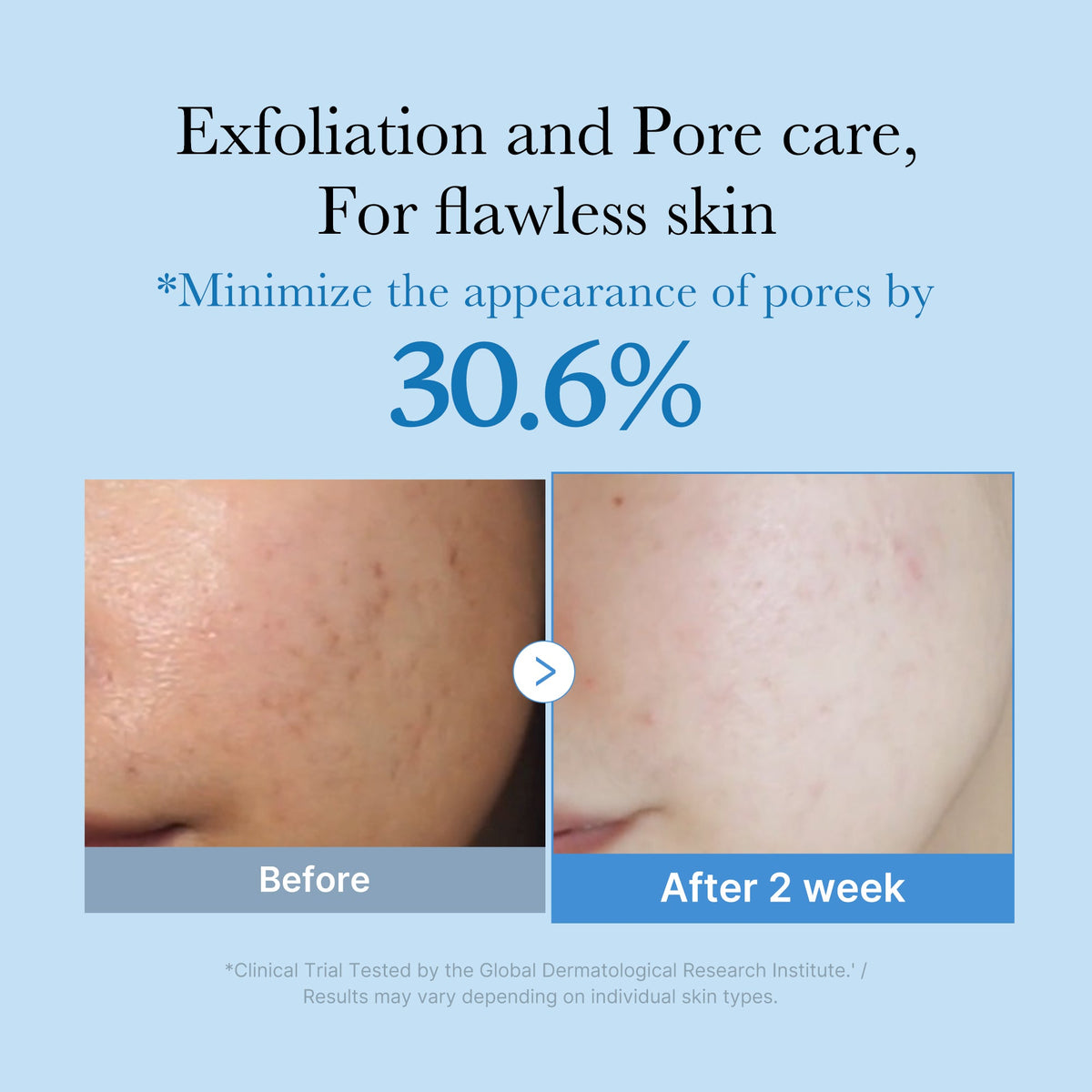zero-pore-toner-b6 01_d6480b4e-3c08-4954-994a-ed5212c1839c.jpg