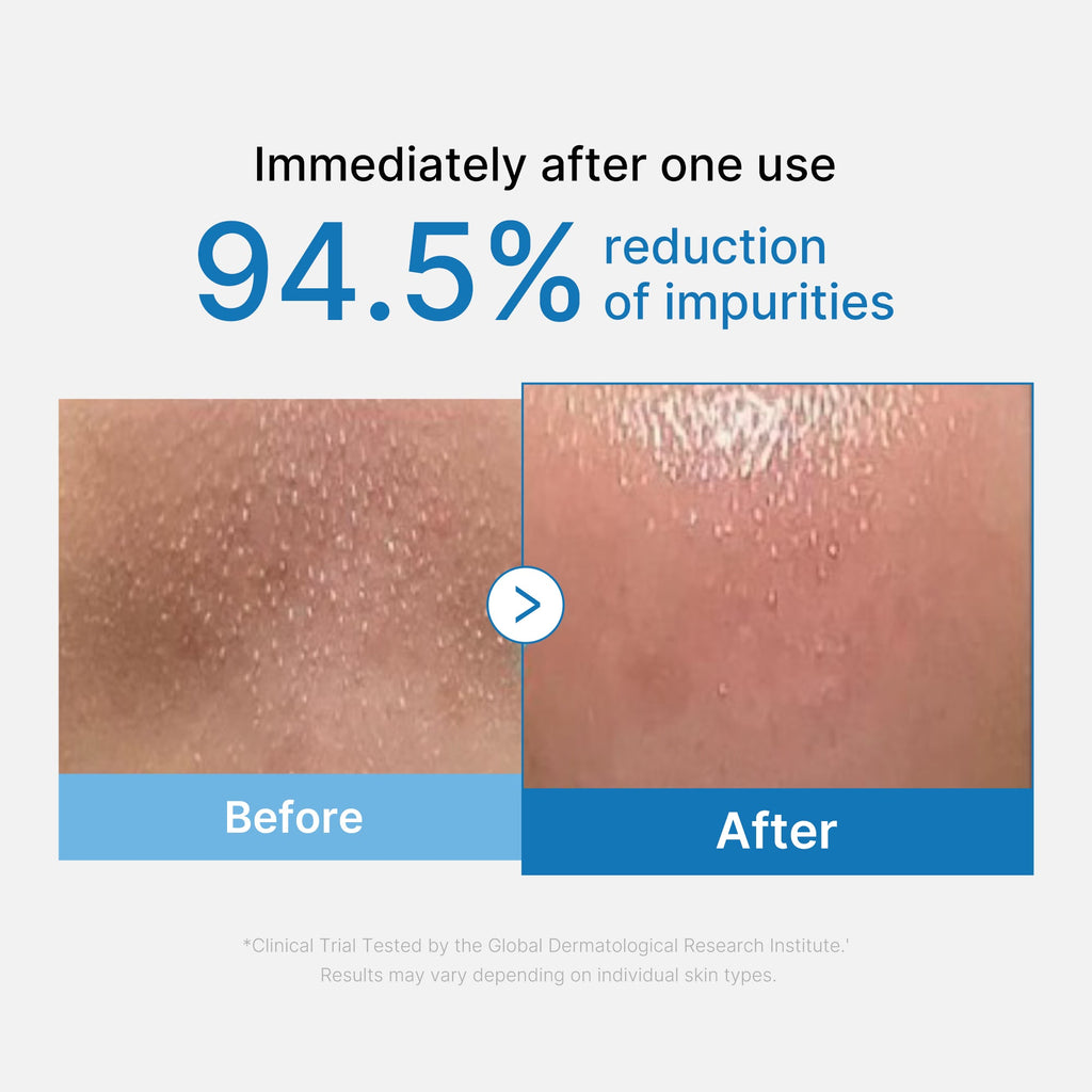 zero-pore-blackhead-deep-cleansing-oil-b3 01_eed557ec-5857-46a2-8b17-dbd67c692dcb.jpg