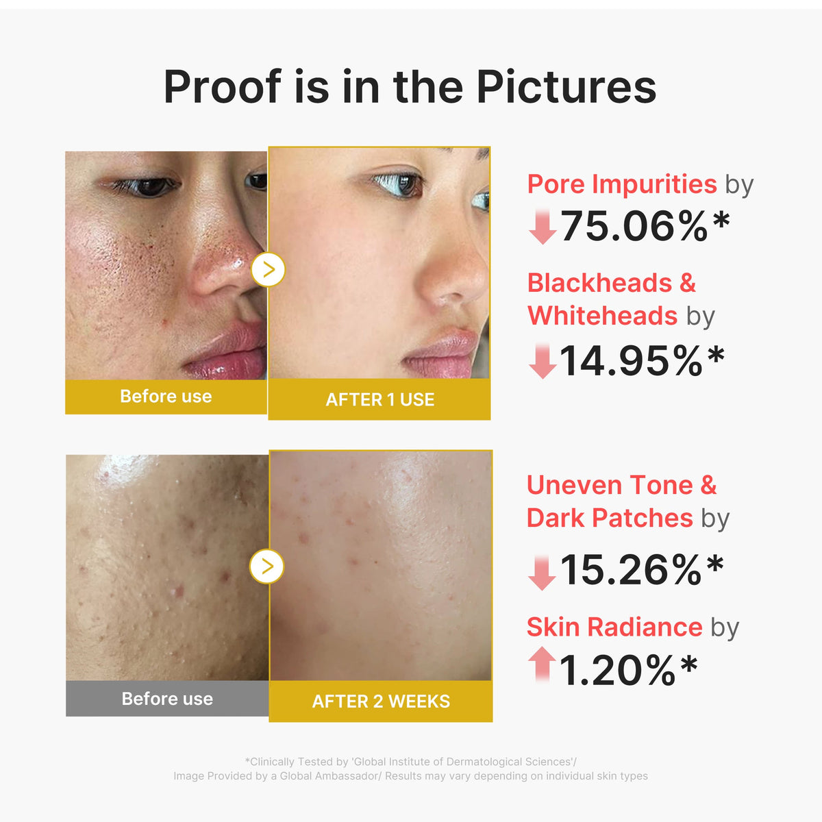 kojic-acid-turmeric-peel-shot-l7 02_45fe66d3-b3f6-4100-aa52-2afd7eded417.jpg