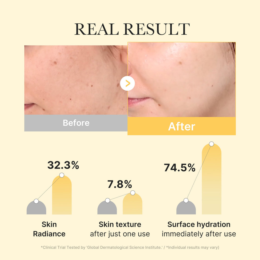 kojic-acid-turmeric-gold-jelly-gel-mask-v6 02_bc3f6017-37f9-4e3c-b32d-f84e8c74138f.jpg