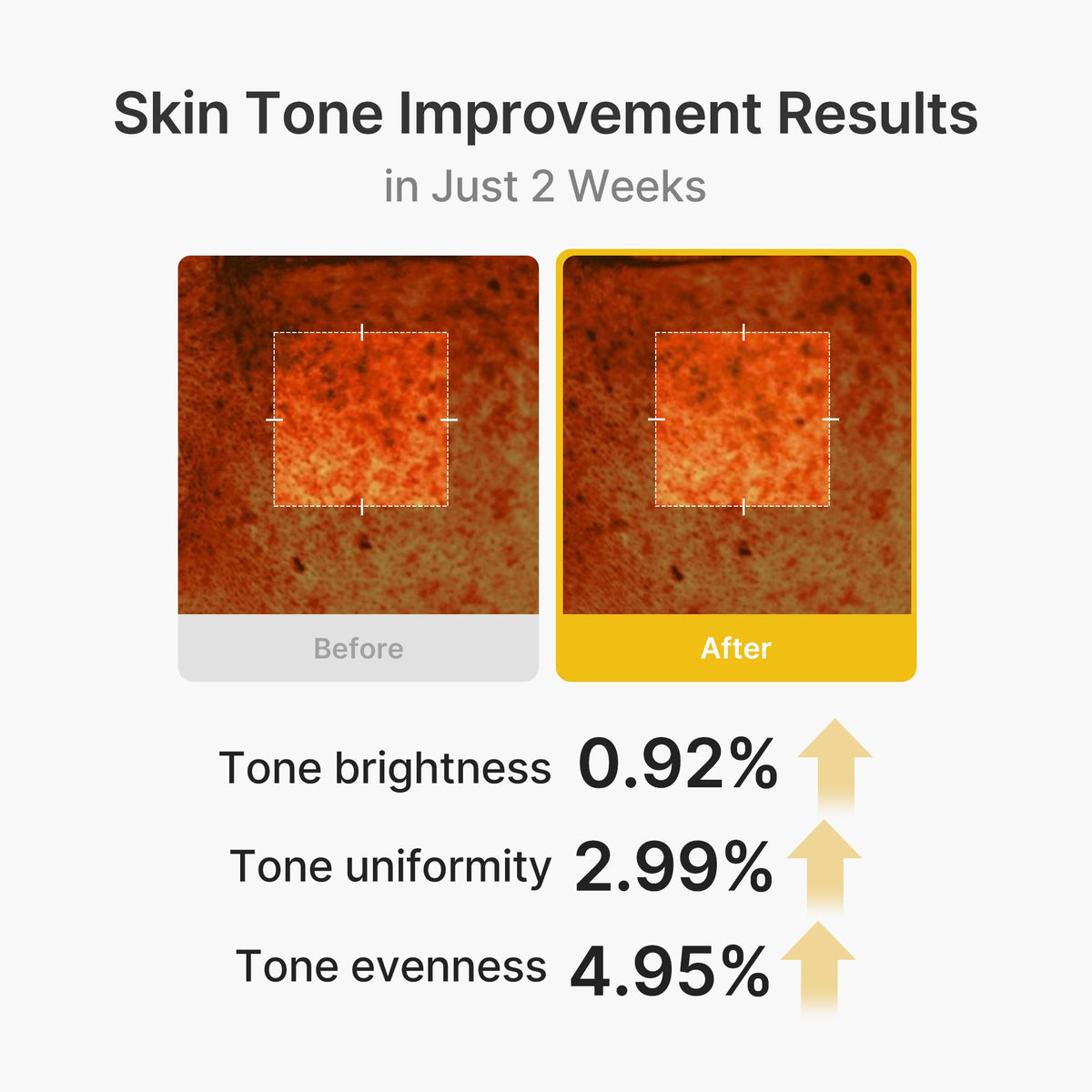 kojic-acid-turmeric-vita-capsule-cream-i3 03_2b626701-fc6c-4702-9e96-a2157a4f7f9d.jpg