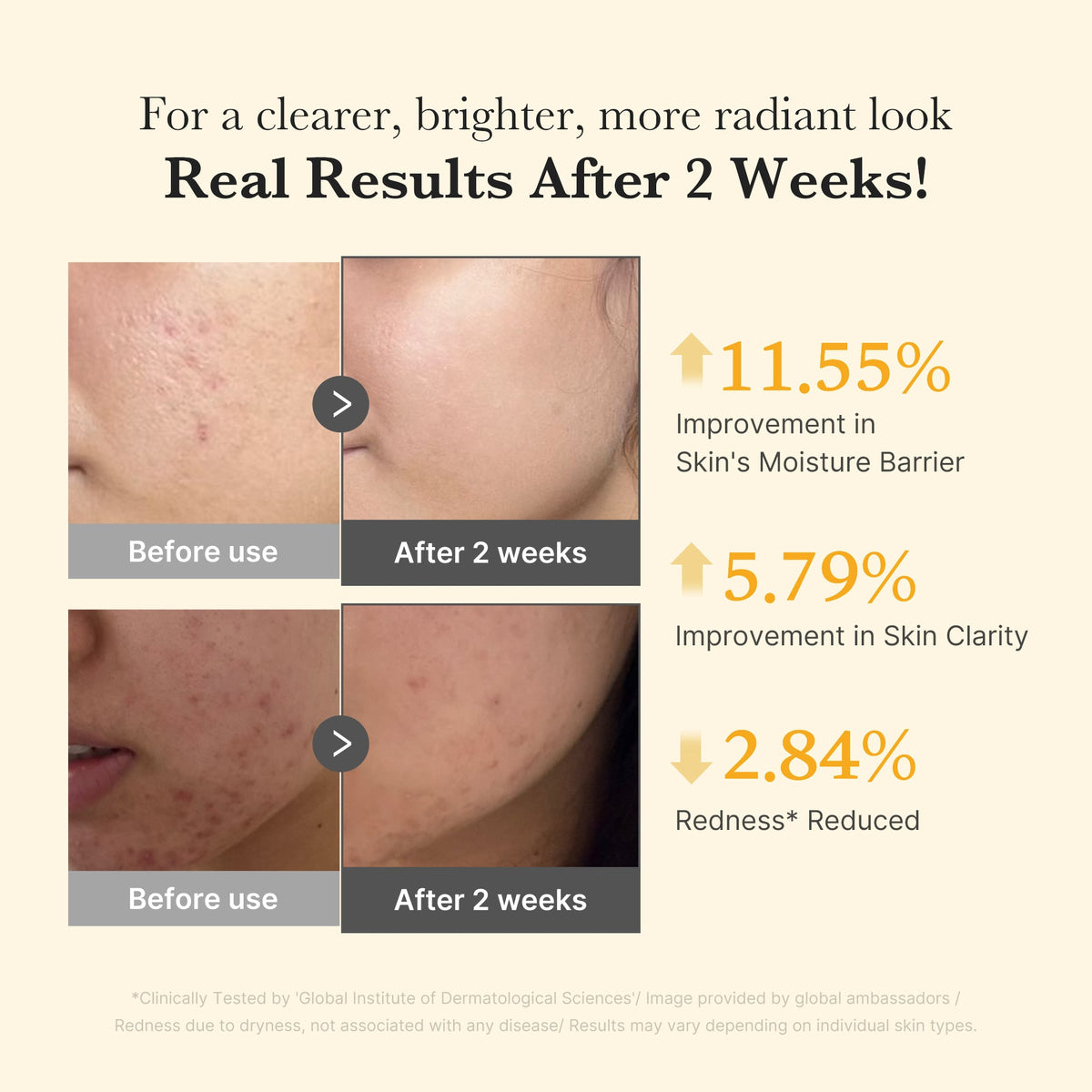 kojic-acid-turmeric-capsule-serum-r7 03_436487f5-76df-490e-8a61-01118373efbd.jpg