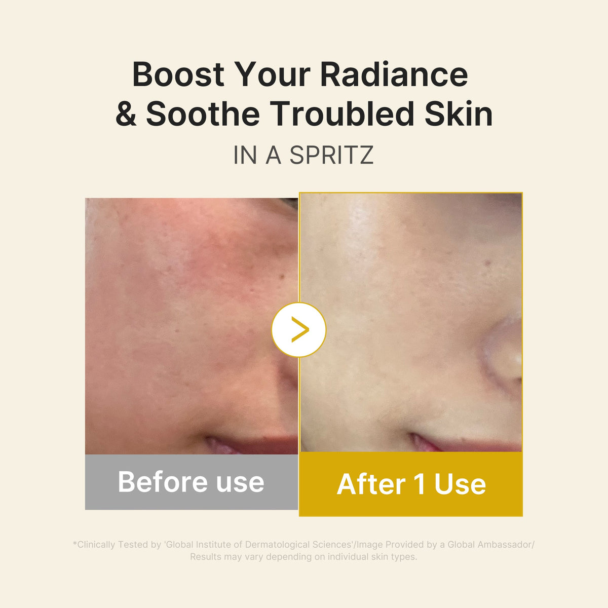 kojic-acid-turmeric-vitamin-gold-jelly-mist-serum-j9 03_dc9cd19e-4e57-49d3-9b66-c7762e8a63f1.jpg