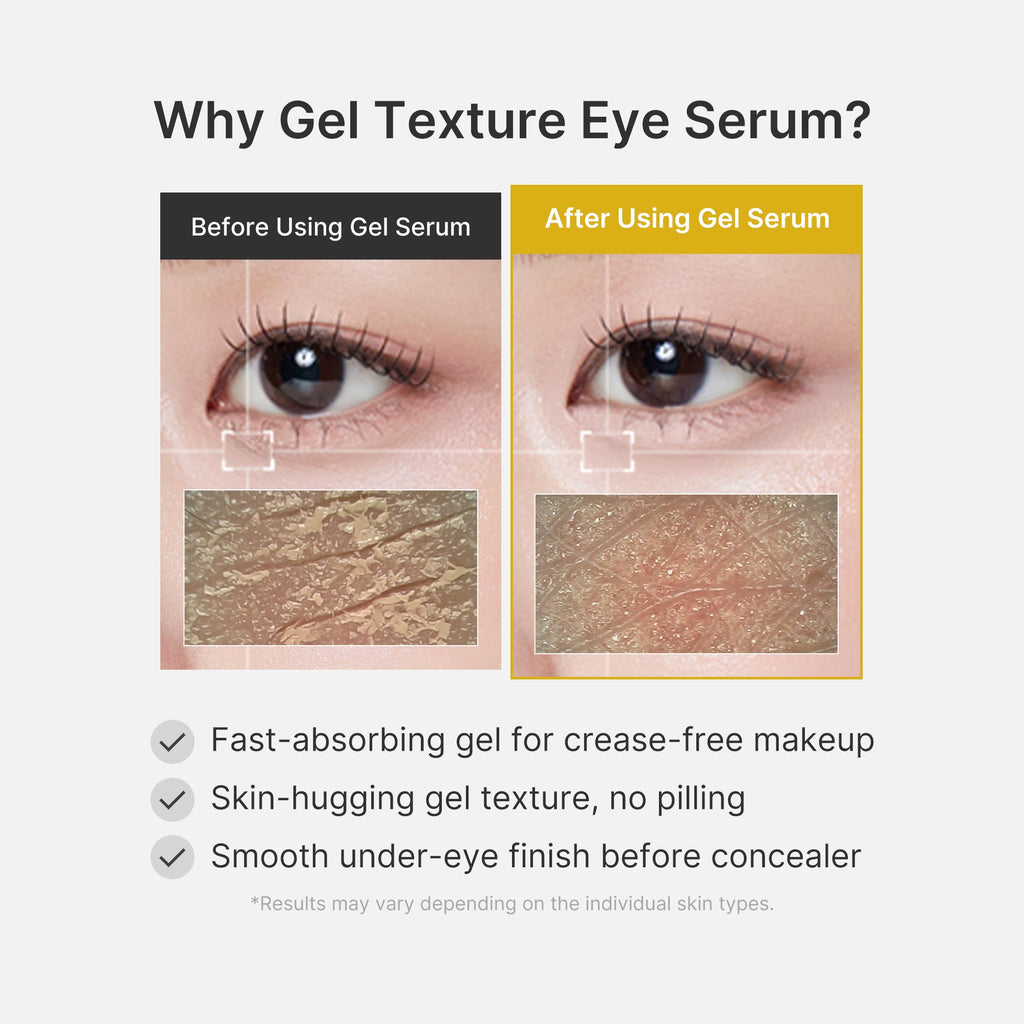 kojic-acid-tumeric-eye-gel-serum-m5 04_0487ef36-49f4-4294-8049-bb55118b05fe.jpg
