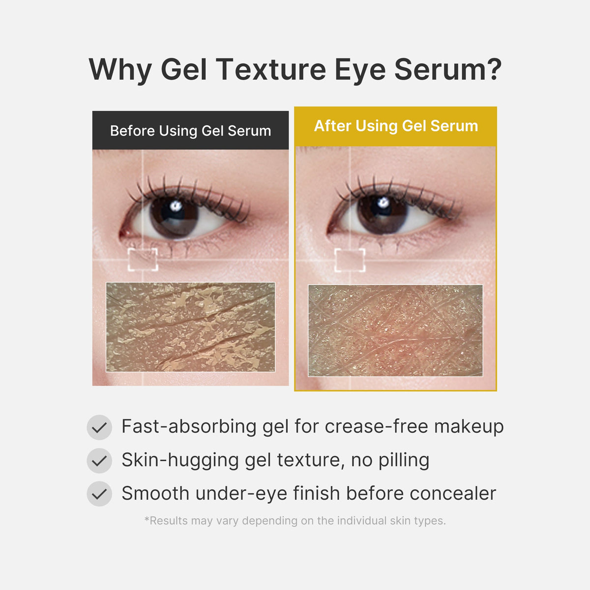 kojic-acid-tumeric-eye-gel-serum-m5 04_0487ef36-49f4-4294-8049-bb55118b05fe.jpg