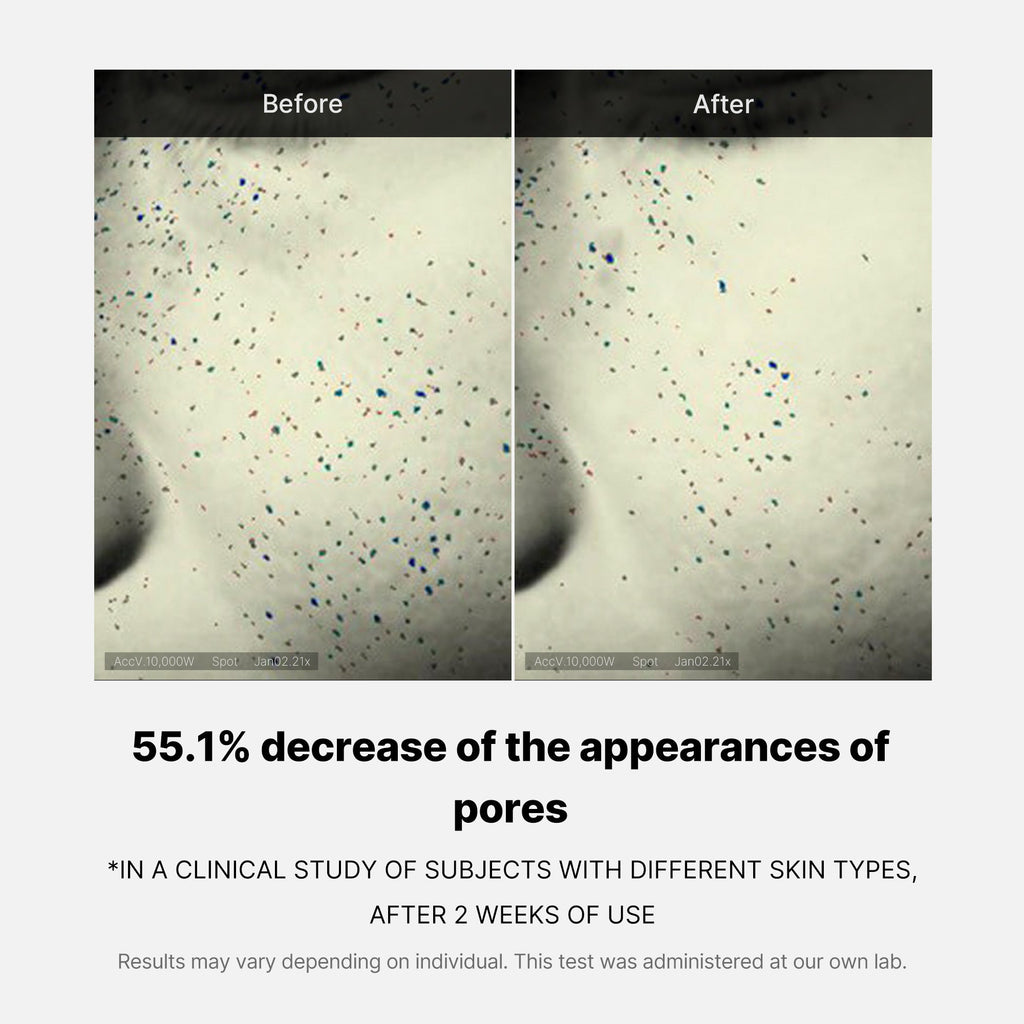 pore-care-duo-o6 05_12ddab8a-64be-4612-8ee1-27e5ec701921.jpg