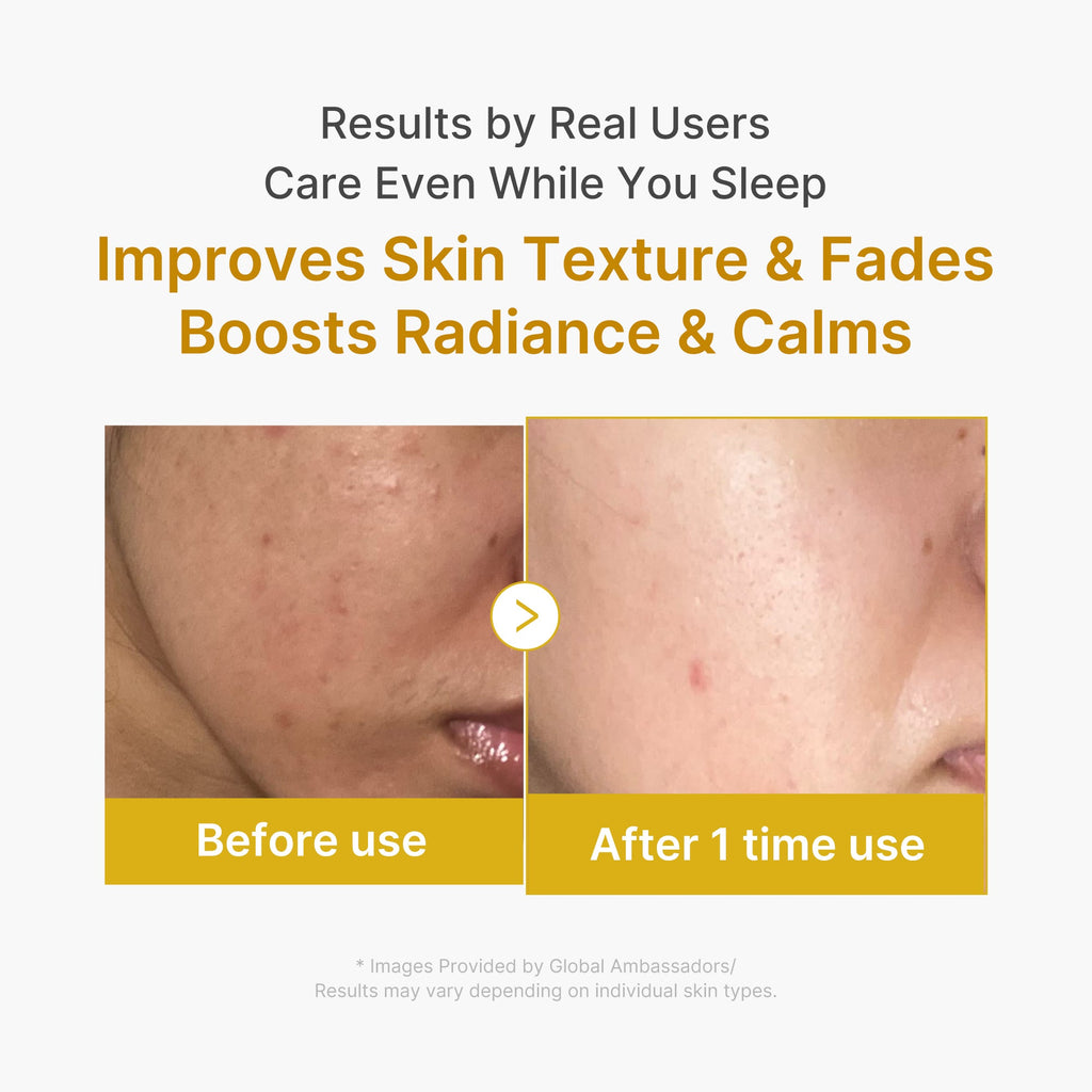 kojic-acid-turmeric-overnight-wrapping-mask-q3 2_04.jpg