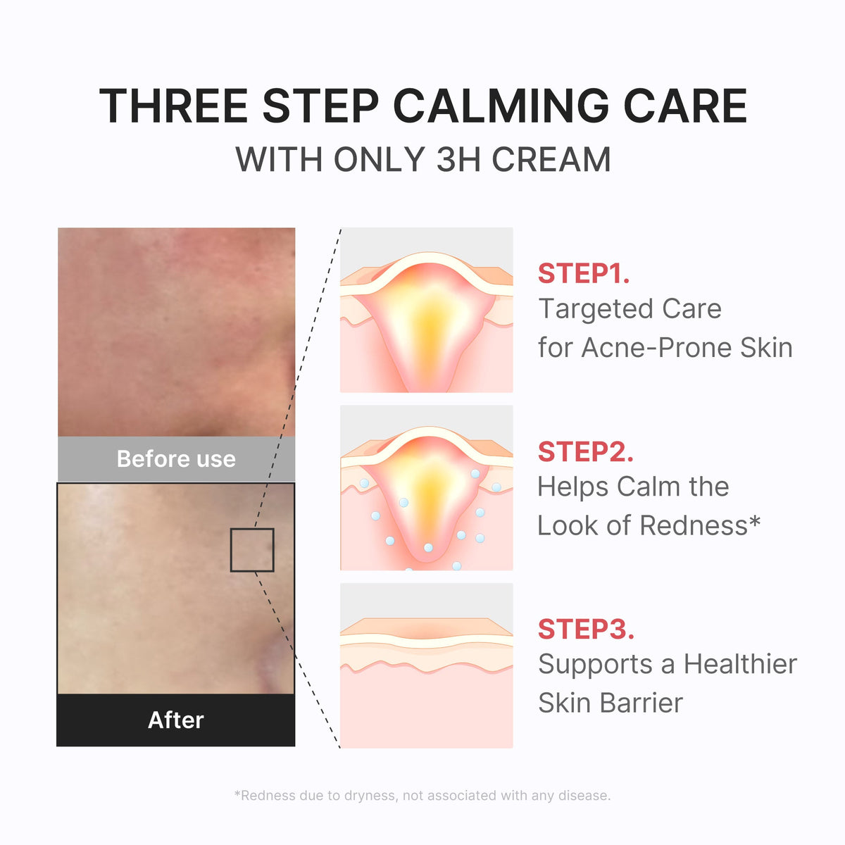 3h-daily-relief-cream-z3 3H_04.jpg