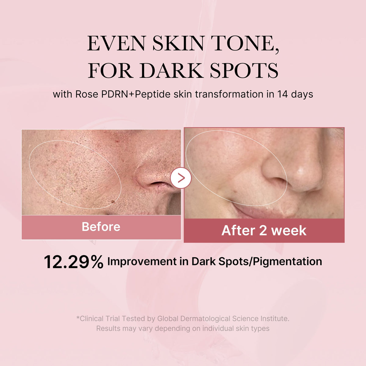 pdrn-pink-peptide-toner-w0 PDRN_01_308c518e-5ac6-4e54-99bd-eabc8796739b.jpg