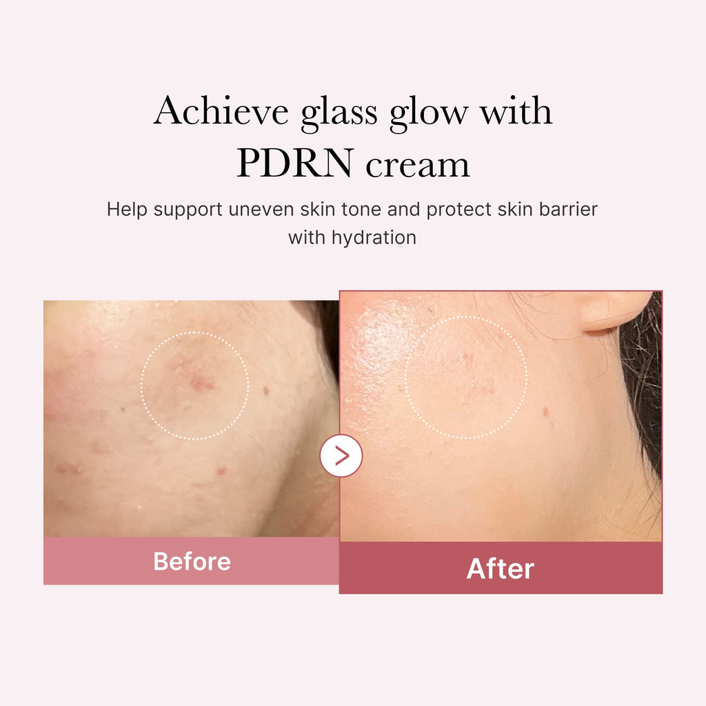 pdrn-pink-peptide-cream-u9 PDRN_02_d7805bfe-cf43-446a-b71b-a276683f136b.jpg