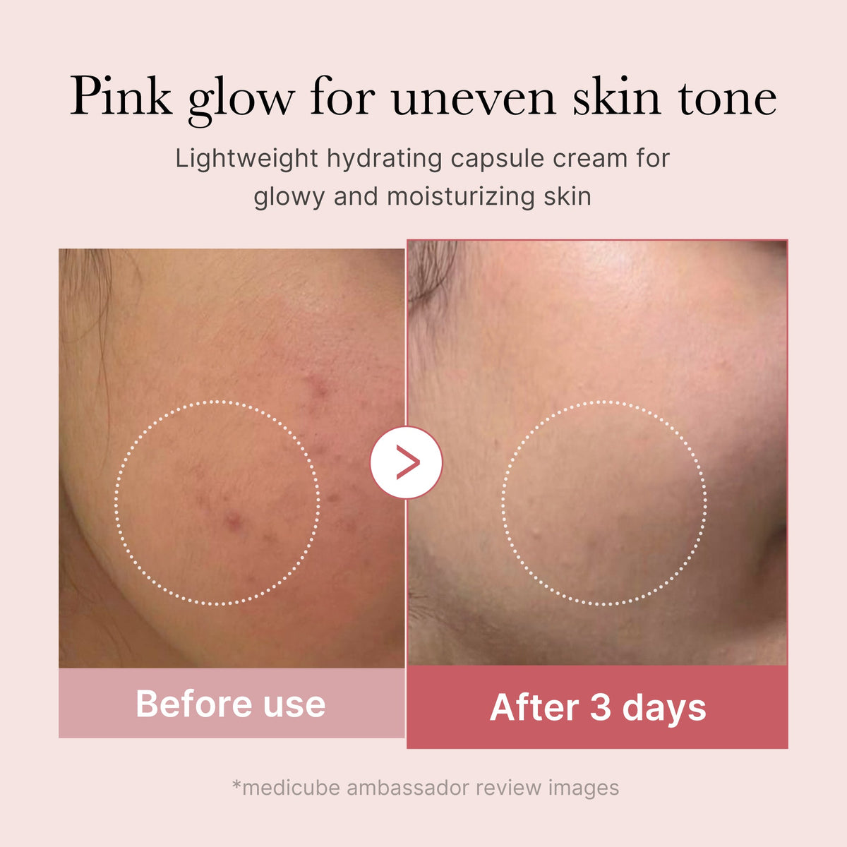 pdrn-pink-collagen-capsule-cream-z3 PDRN_03_058d09d8-4f44-4b1e-927c-e27b1738ae51.jpg