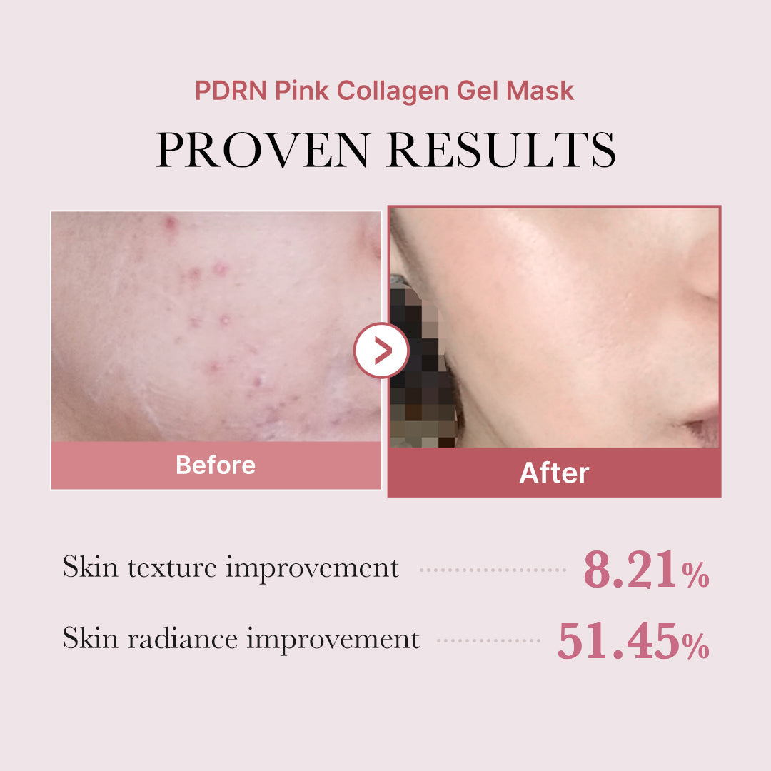 salmon-pdrn-pink-collagen-jelly-gel-mask-q3 PDRN_12.jpg