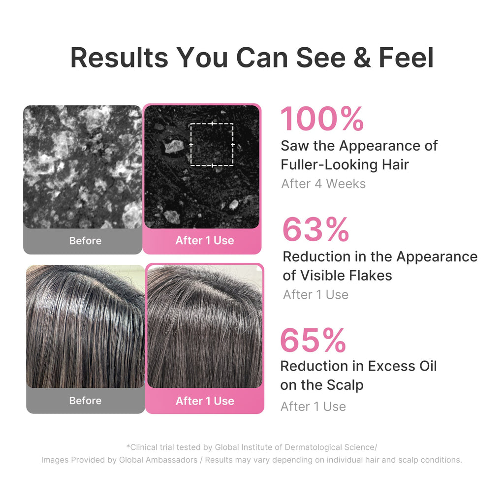 rosemary-pdrn-cooling-thickening-shampoo-q9 US_ME_RosemaryShampoo_th04.jpg